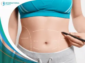 liposuction6 كم تستغرق عملية شفط دهون البطن