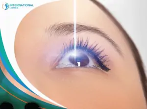 LASIK علاج العيون في تركيا