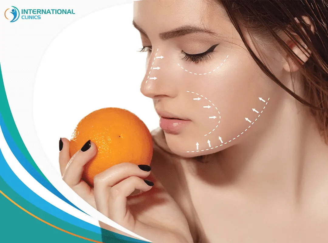 Face liposuction شفط دهون الوجه