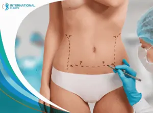 abdomen cosmetic عمليات تجميل النساء