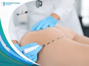 butt beautification عمليات التجميل بعد الولادة في تركيا