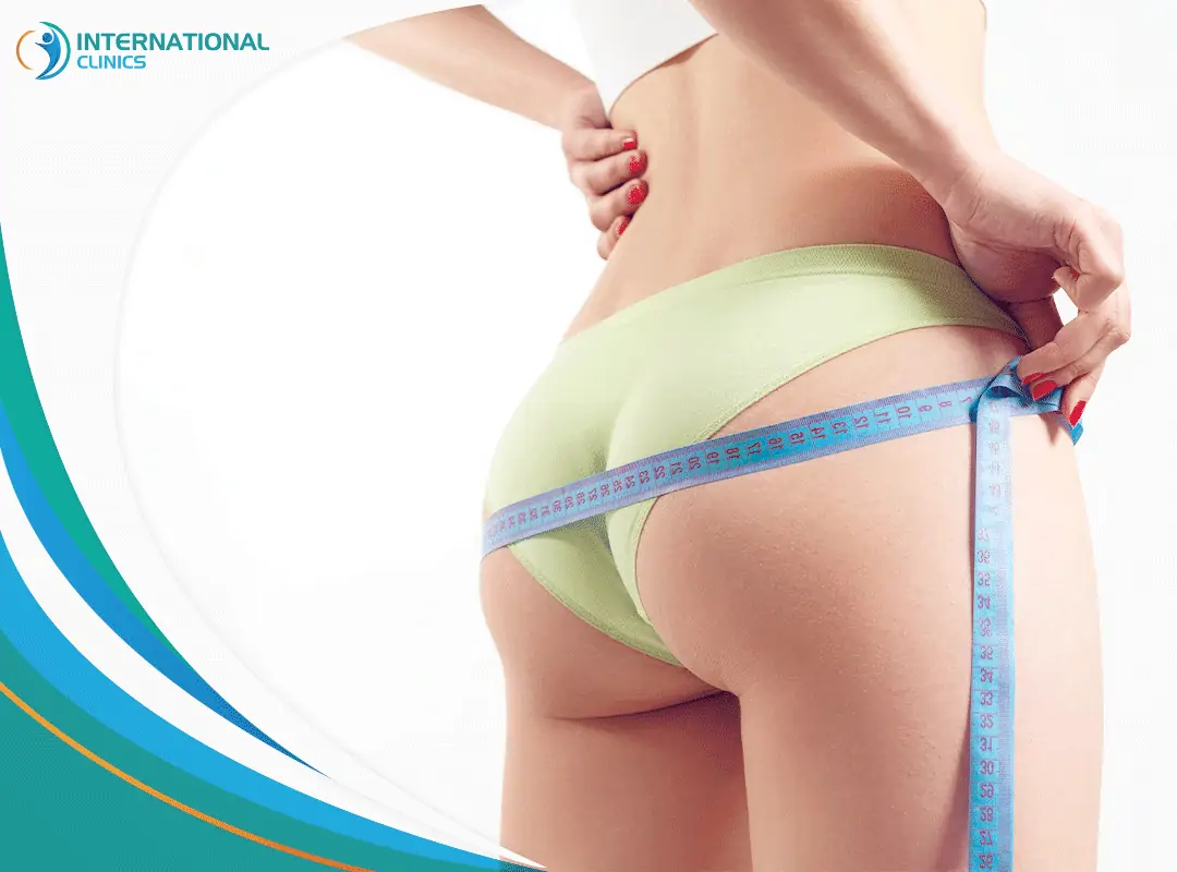 buttock liposuction 2 شفط دهون الارداف