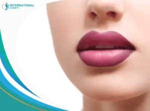 filled lips 1 عملية شد الوجه الجزئي