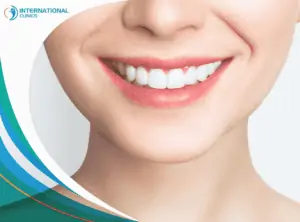 hol4123941 علاج الأسنان في تركيا