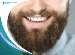 Beard and mustache hair transplant الشعر المزروع