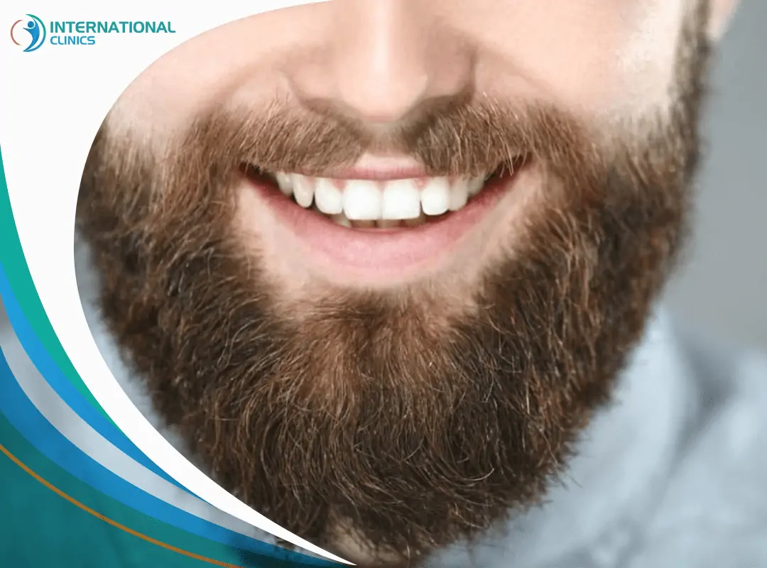 Beard and mustache hair transplant زراعة الشنب والذقن