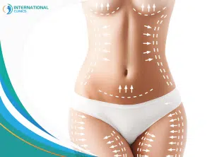 a2245816a24f304f52ad7123fd338d03 How much is a liposuction?