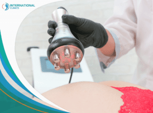 laser lipo شفط دهون البطن بعد الولادة