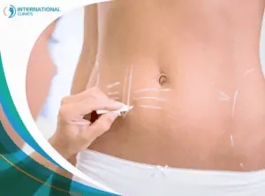 Liposuction3 مدة الشفاء من عملية شد البطن