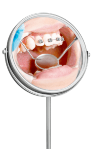 32 Endodontic Treatment
