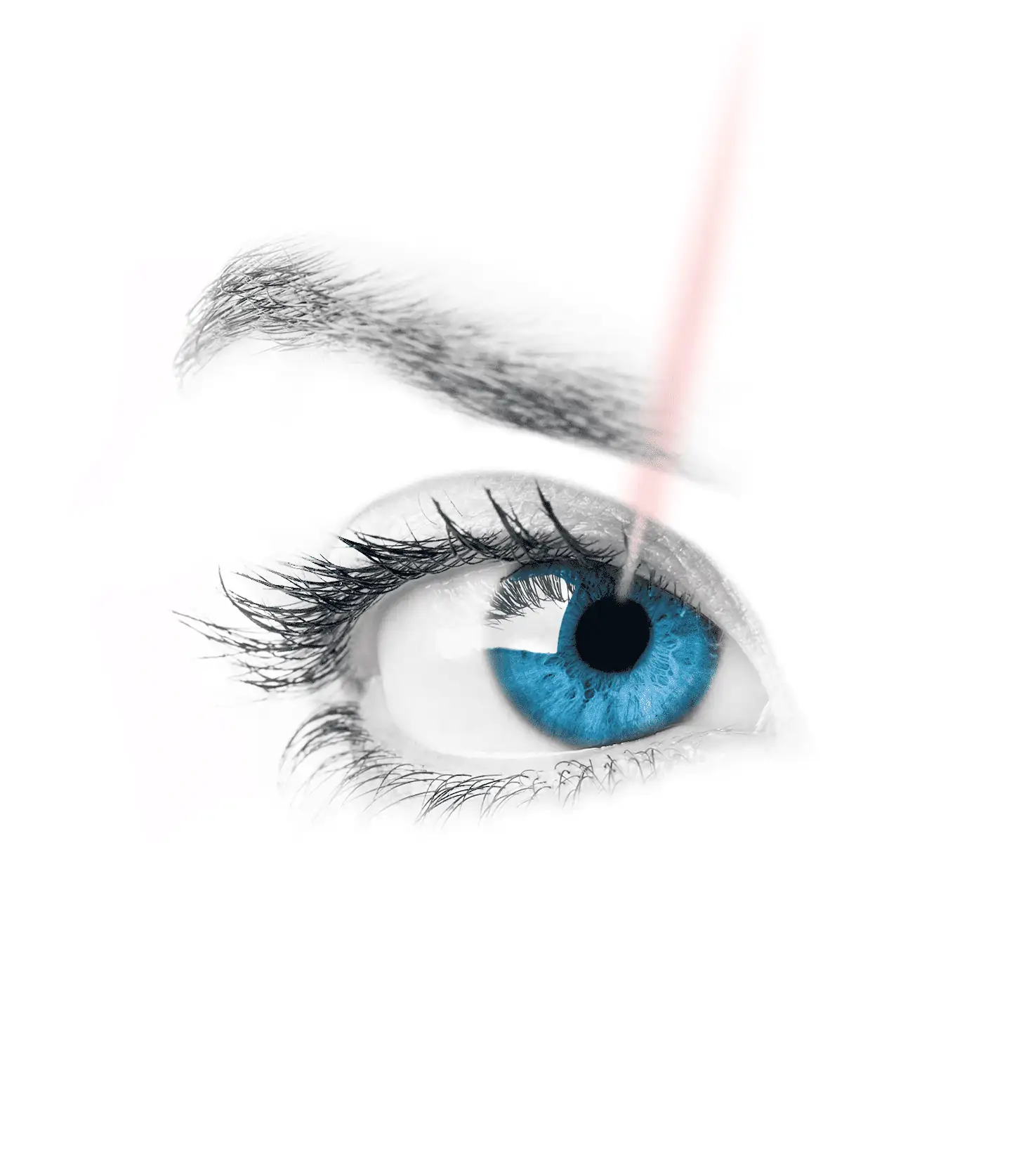 Cirugía Ocular LASIK
