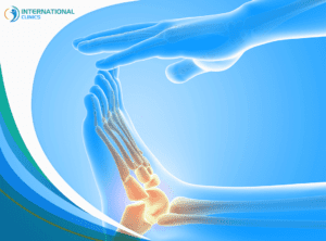 foot and ankle استبدال المفاصل