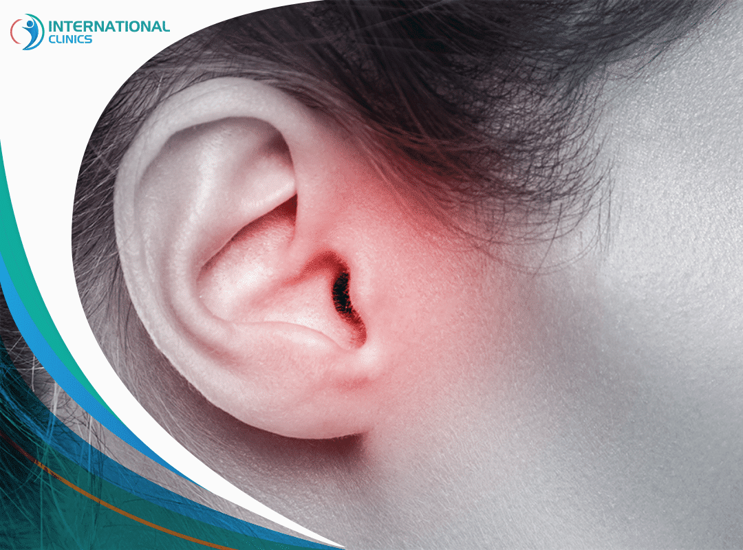 التهاب الأذن الوسطى: تعرف على الأسباب والأنواع وطرق العلاج 
