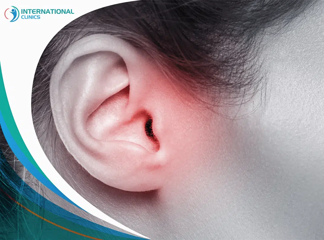 التهاب الأذن الوسطى: تعرف على الأسباب والأنواع وطرق العلاج 2024