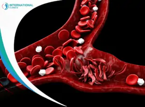 Sickle cell anemia سرطان غشاء الجنب