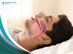 Snoring surgery and shortness of breath during sleep اعتلال الشبكية السكري