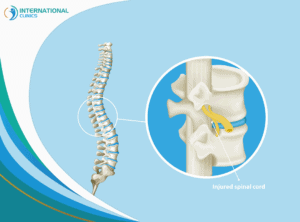 Spinal cord injuries أورام العمود الفقري