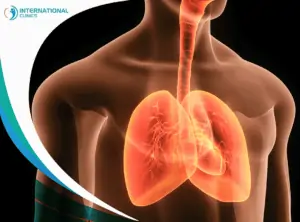 advanced emphysema التشوهات الشريانية الوريدية