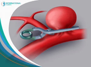aneurysm ورم الغدة النخامية,أورام الغدة النخامية