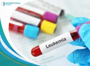 leukemia زراعة الجلد