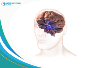 pituitary gland tumors الورم الدموي الدماغي