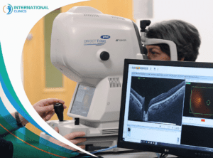 tomography of the retina تقنية الليزك