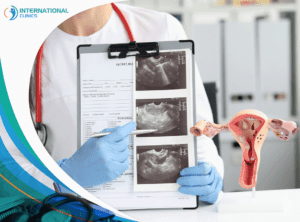 uterus ultrasound ربط القنوات