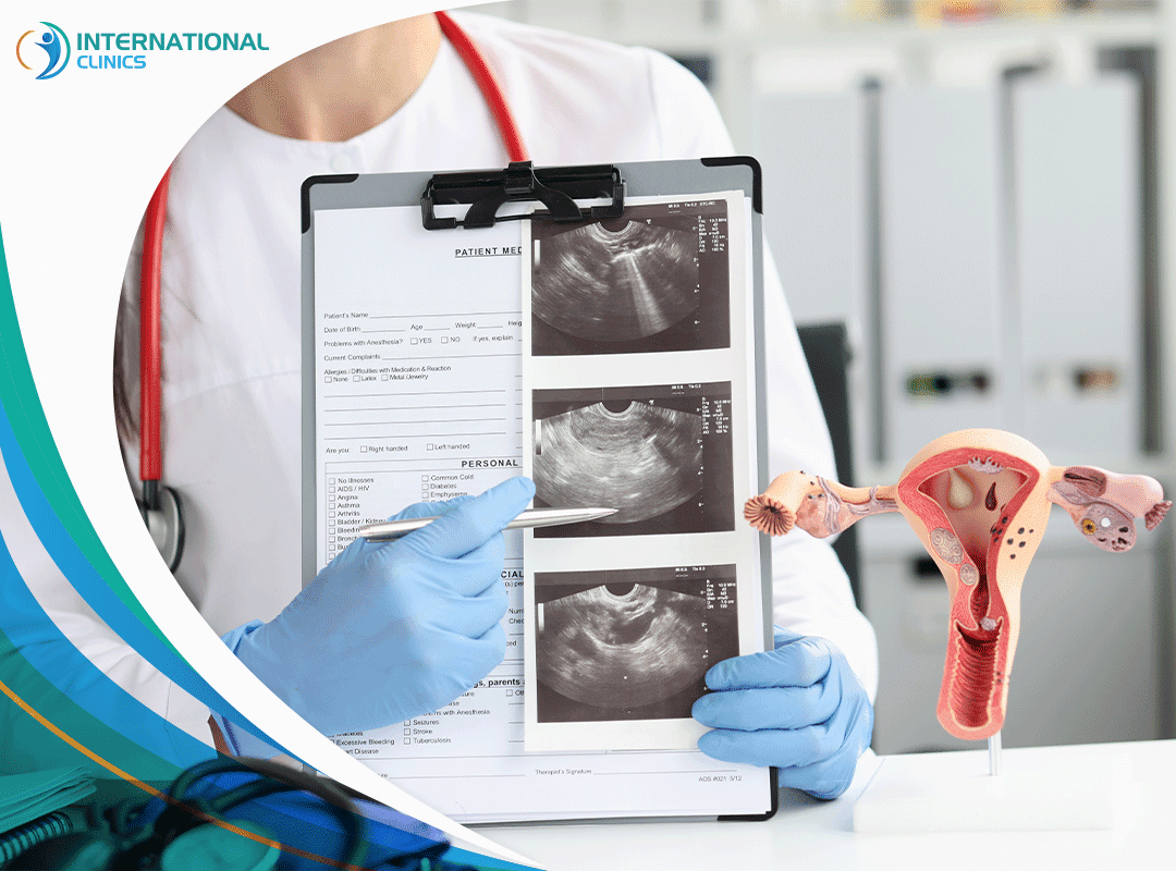 uterus ultrasound العقم عند النساء