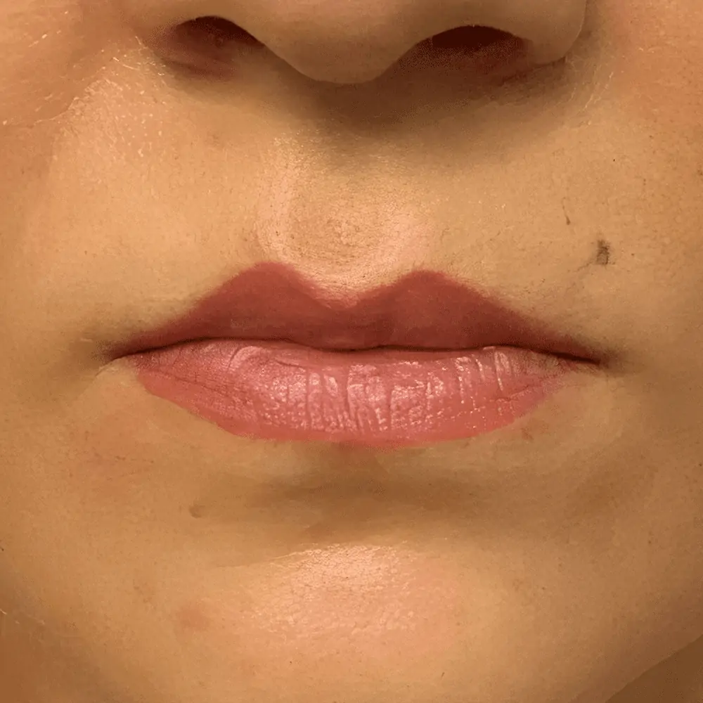 lips before 4