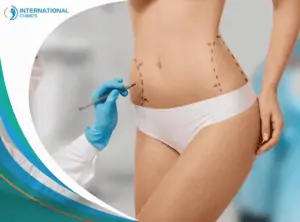 Abdominoplasty Thigh Lift in Turkey