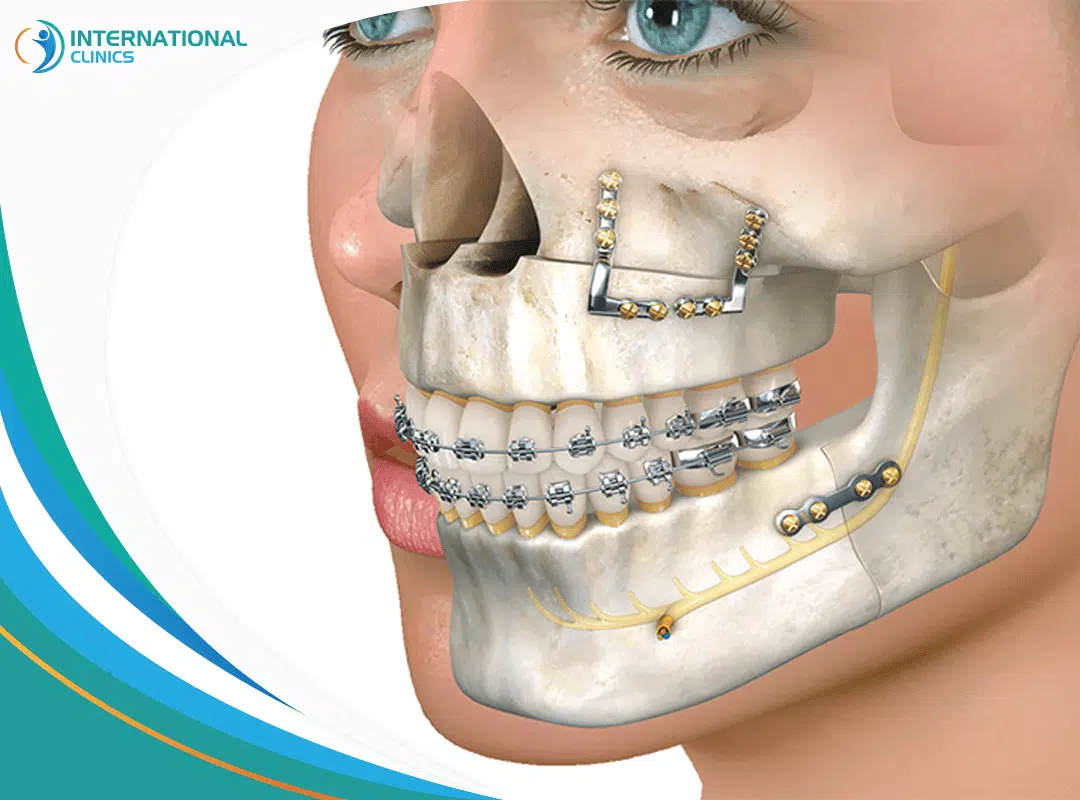 Maxillofacial Surgery in Turkey: Everything You Need to Know