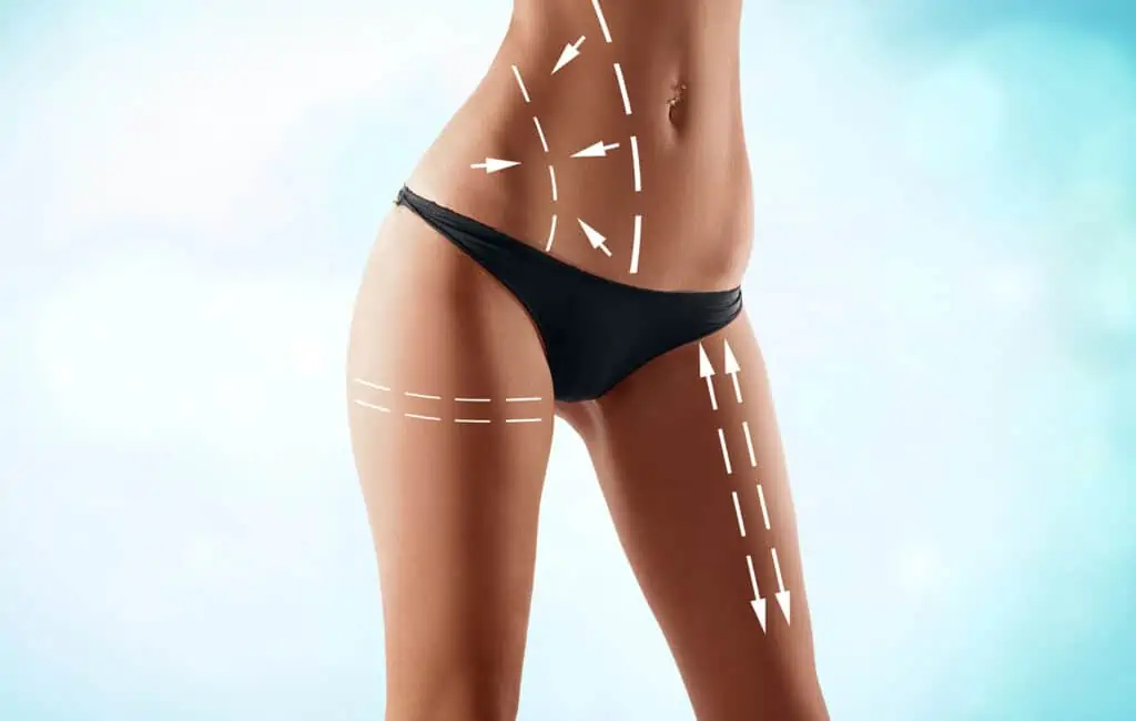 Liposuction and liposuction 4 تفتيت وشفط الدهون