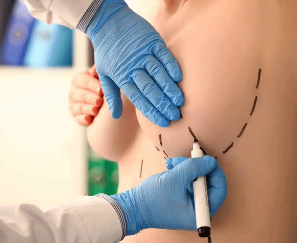 examination female breast by mammologist عمل کوچک کردن سینه در ترکیه