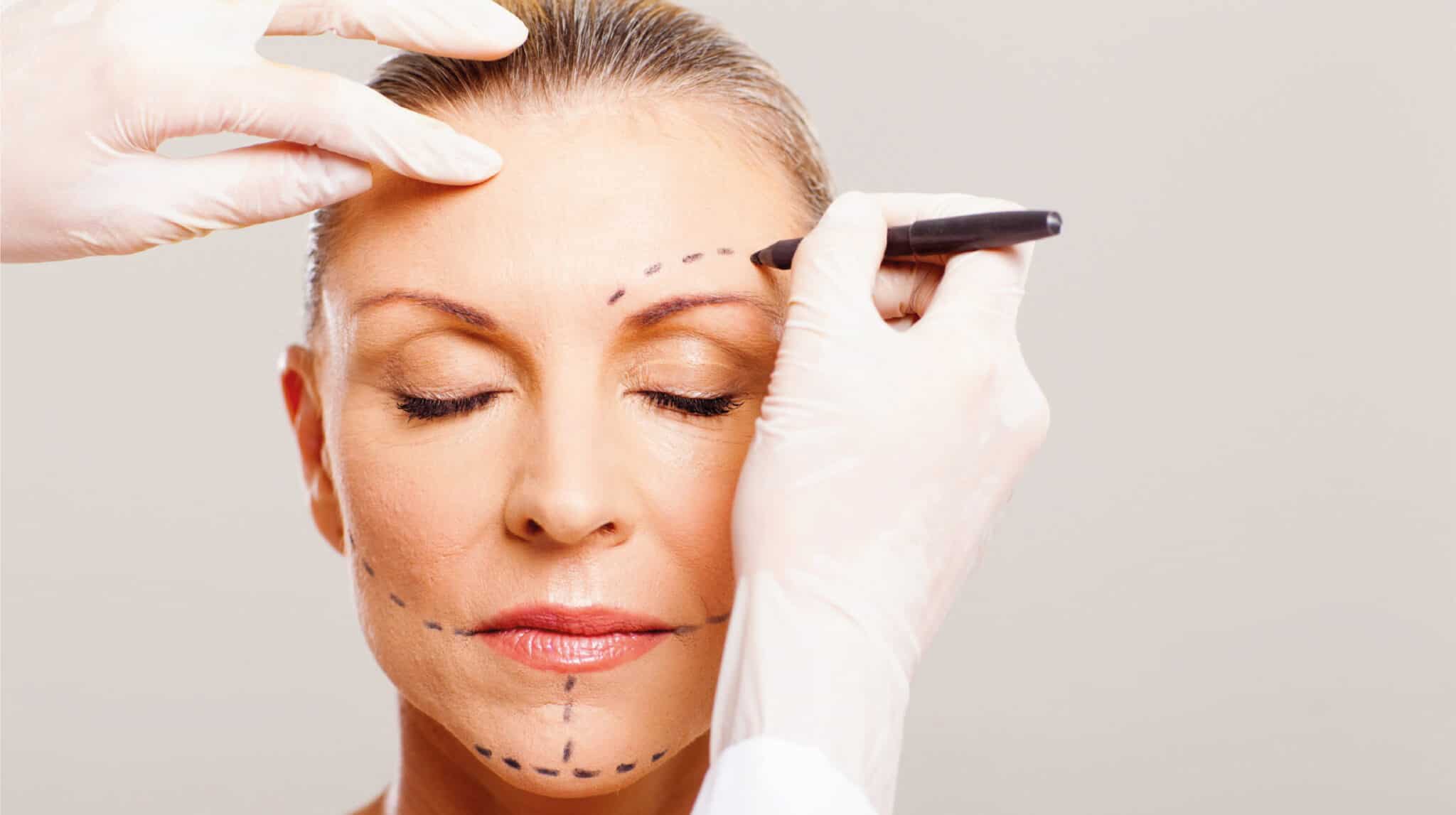 Facelift in Turkey Advantages & Costs 2022 International Clinics