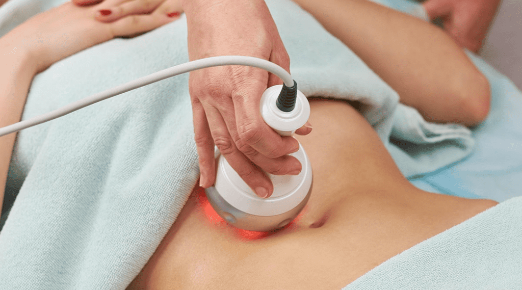 lipolaser2 عمليات تجميل النساء