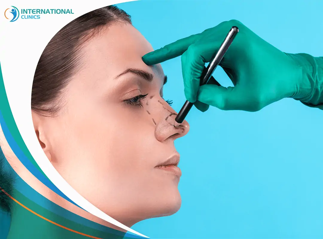 Rhinoplasty (Nose Job) In Turkey: Your Comprehensive Guide 2024