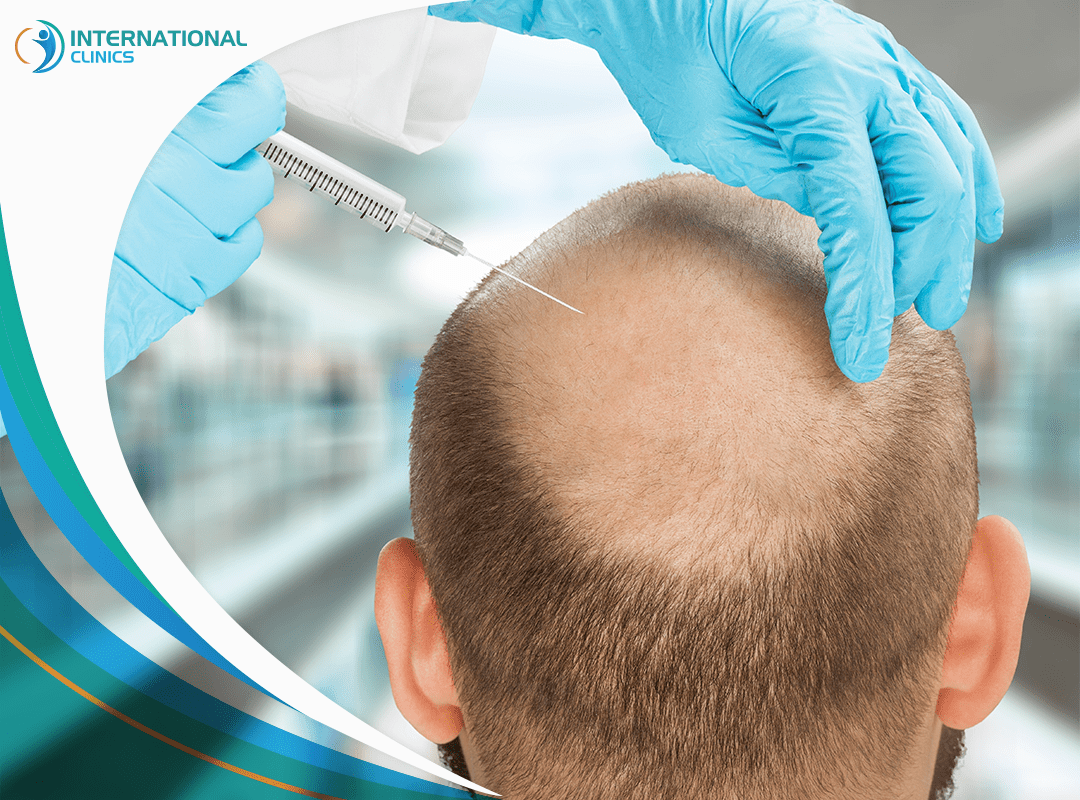 طرق علاج تساقط الشعر | تعرف على الأسباب وطرق الوقاية