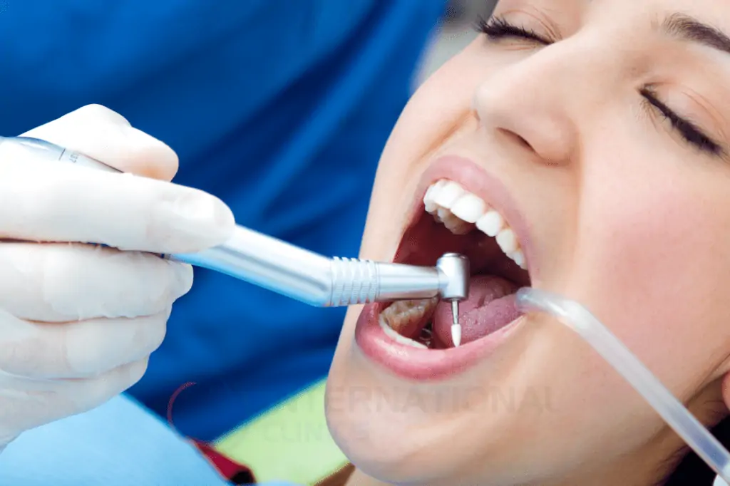 تصنف زراعة الأسنان ضمن أنواع تجميل الأسنان المحورية