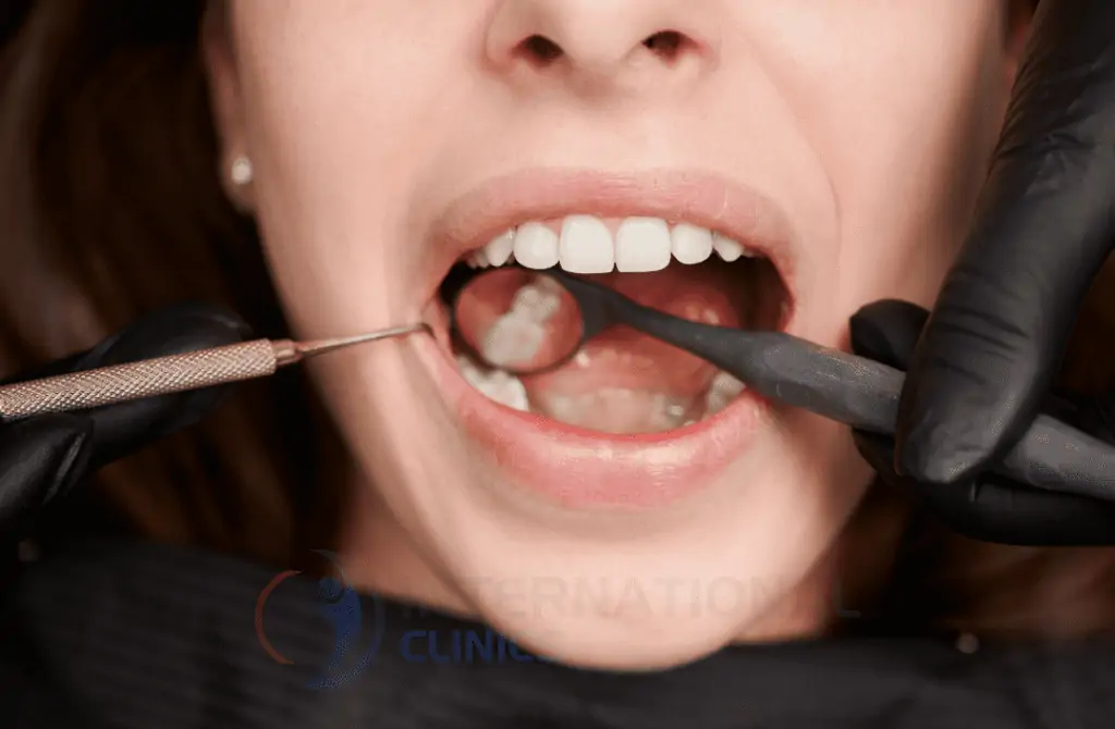 جراحة الأسنان