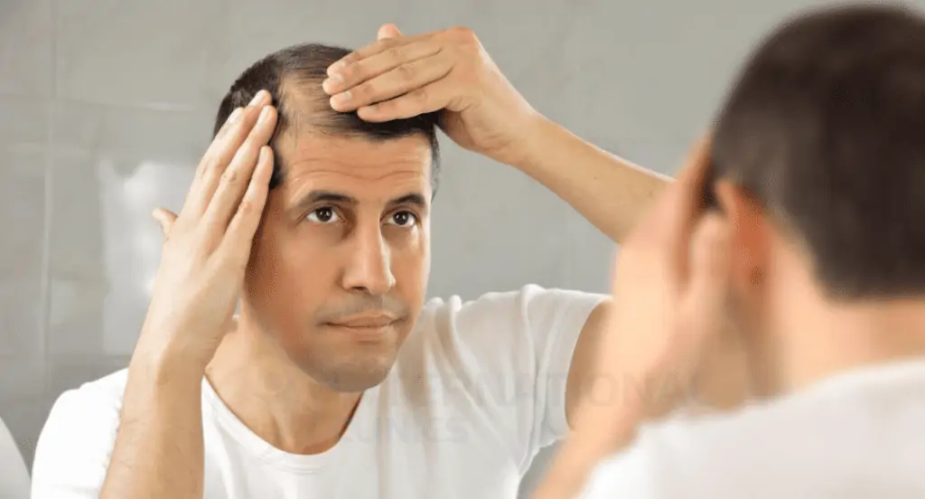 علاج الشعر بالطرق الطبيعية