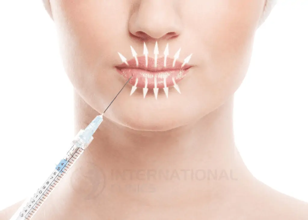 Lips plastic surgery cover 3 تجميل الشفايف