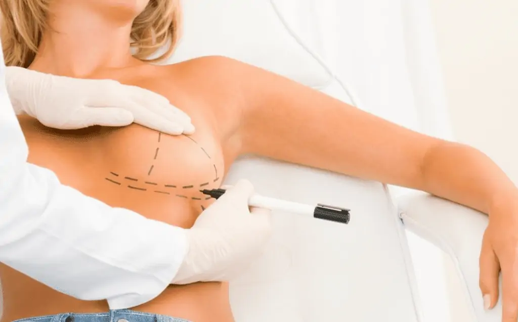 Plasma injection for breast augmentation 2 حقن البلازما لتكبير الثدي