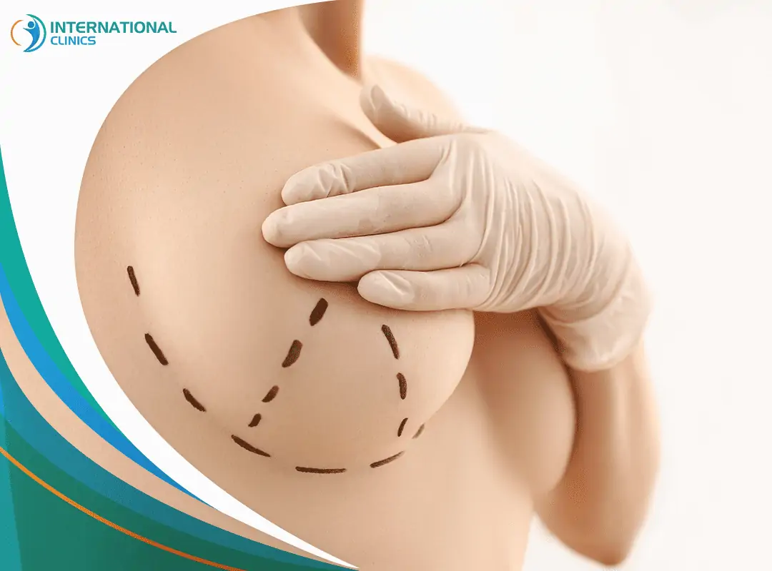 breast reduction 0 تصغير الصدر من خلال شفط الدهون
