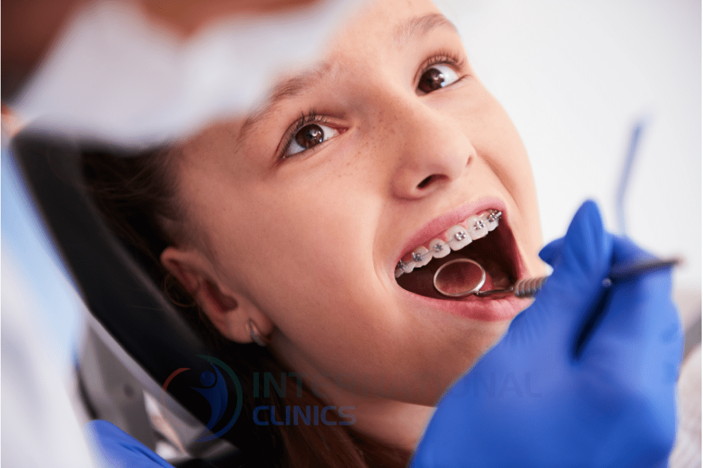 يعاني بعض الأطفال من عيوب خلفية ويعد العمر المناسب لإجراء تقويم الأسنان بين الثامنة والرابعة عشر