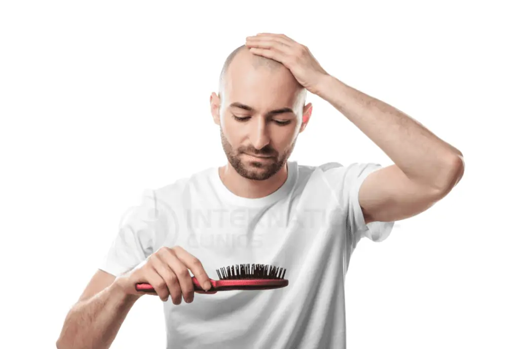 hair transplant cover 4 طرق علاج تساقط الشعر