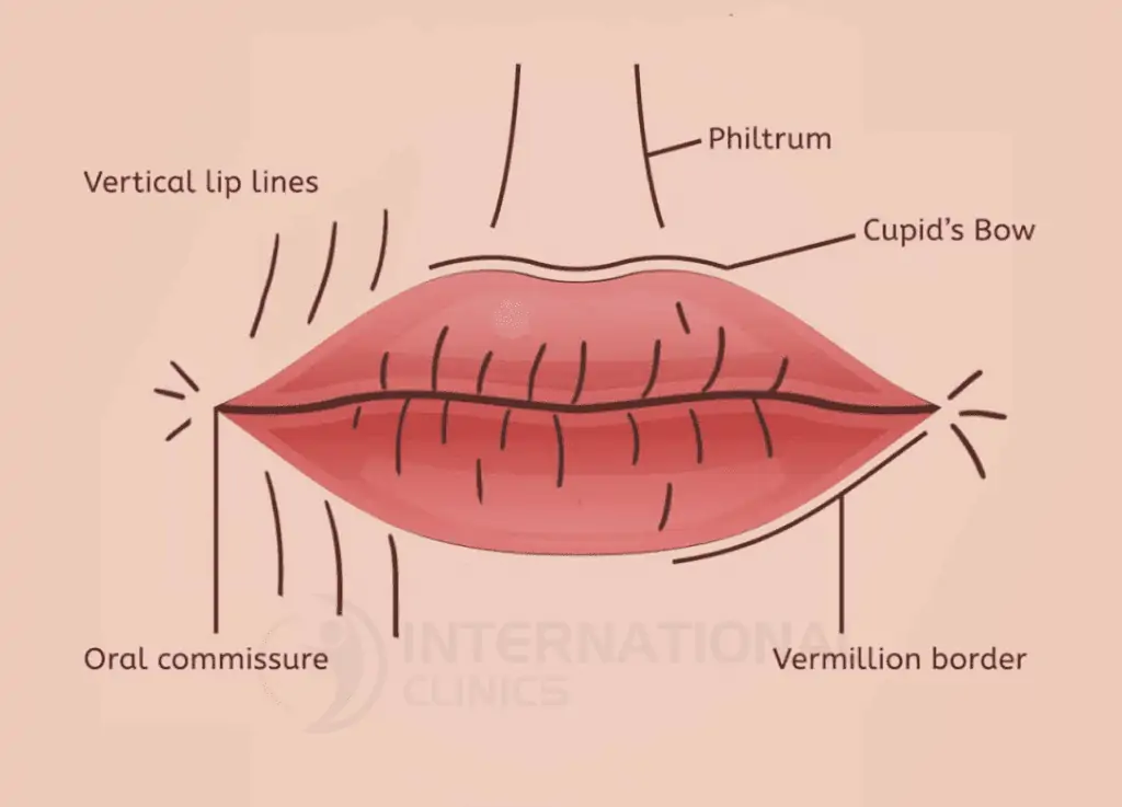 lip reduction cover 2 تصغير الشفايف