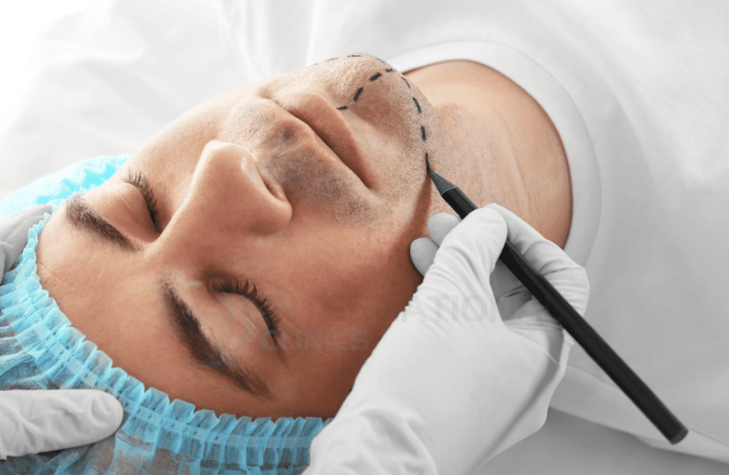 عادة ما تتم تلك العملية مع عملية تجميل الأنف، لضمان تحقيق التناسق المطلوب بين عظام الوجه والذقن والحصول على مظهر مفعم بالرجولة والجاذبية.