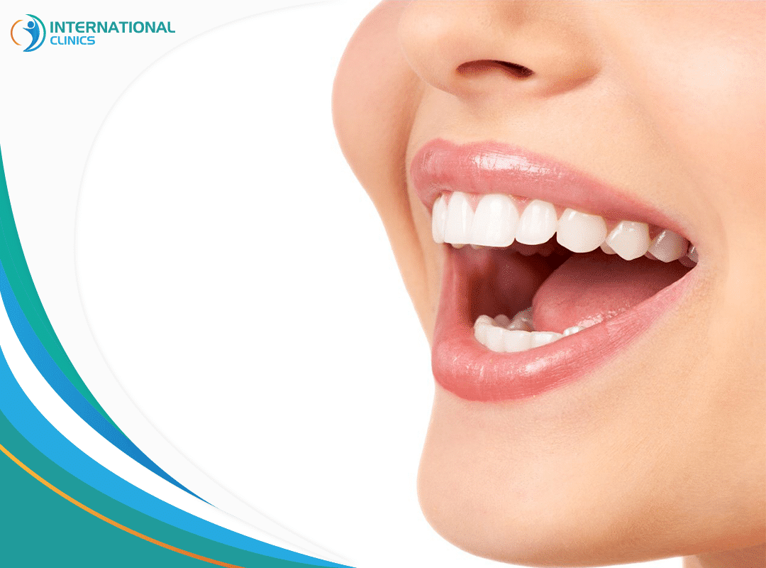 تبييض الأسنان بالليزر | الميزات والعيوب ونصائح بعد الاستخدام