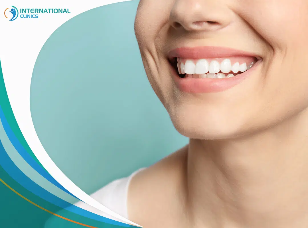 درمان دندان در ترکیه – انواع و ویژگی ها
