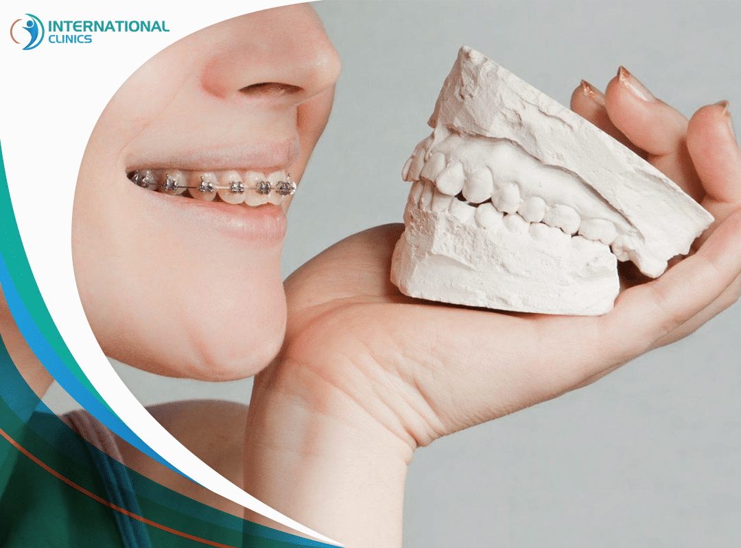 الفرق بين تقويم الأسنان وتقويم الفك | أسباب الاستخدام وطرق العلاج